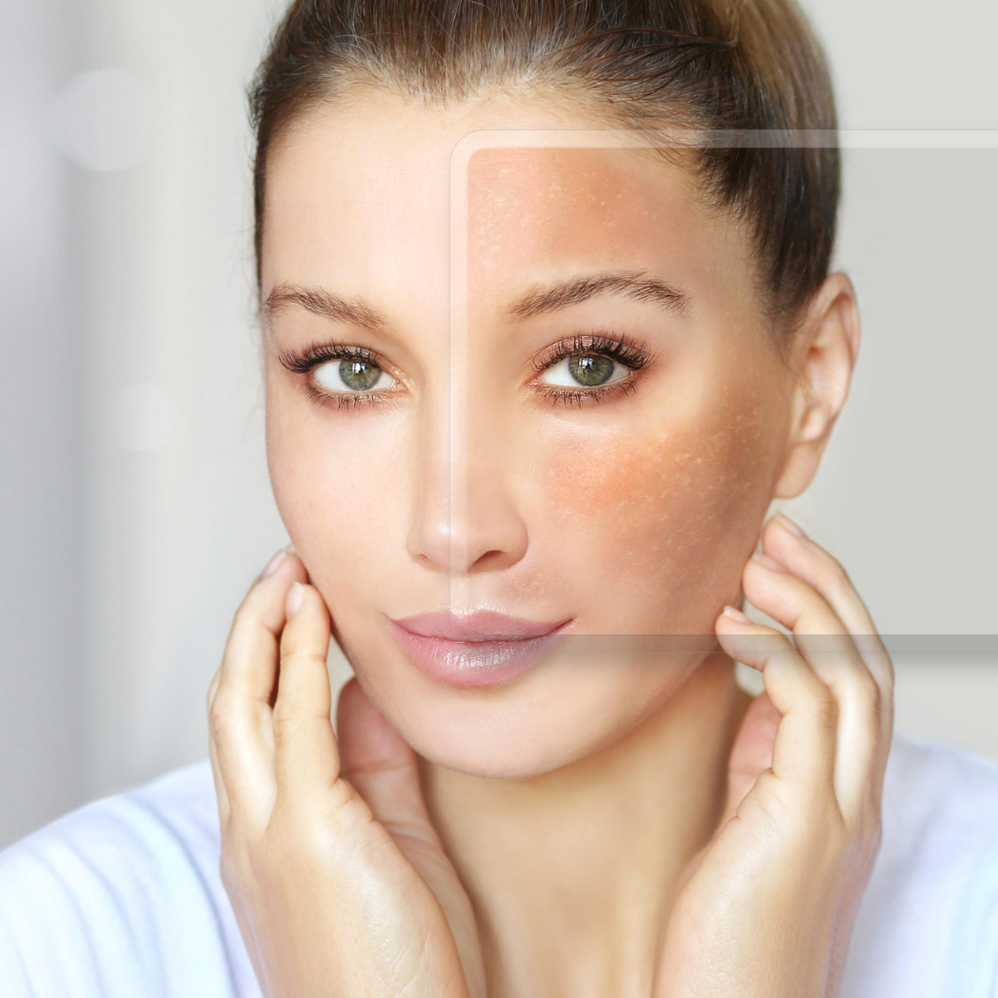 Beauty Treatment